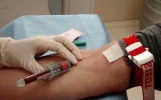 Нейтрофіли підвищені в крові: причини та методи лікування